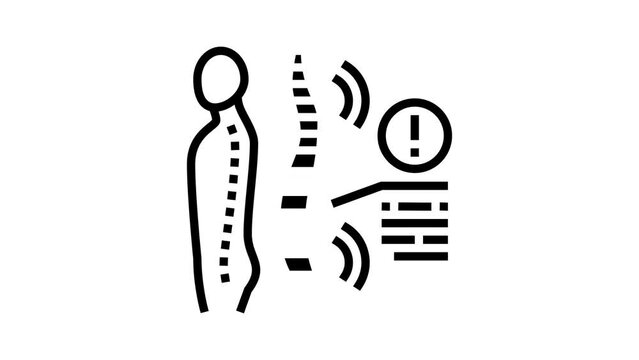 spondyloarthropathies health problem line icon animation