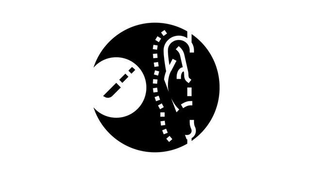 otoplasty surgery glyph icon animation