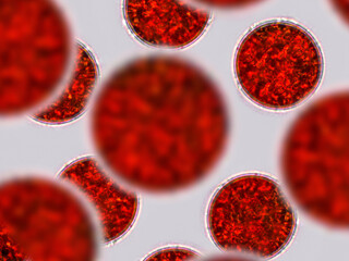 Haematococcus pluvialis cyst algae under microscopic view - haematocyst