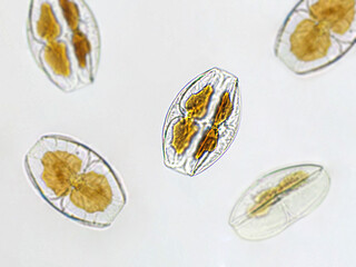 Amphora sp. algae under microscopic view, Diatoms, phytoplankton, fossils, silica, golden yellow...