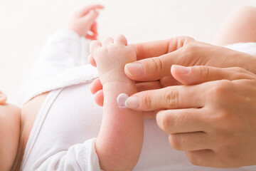 Young adult mother finger applying white medical ointment on newborn arm. Red rash on skin. Allergy from milk formula or mother milk. Care about baby body. Closeup. Side view. - obrazy, fototapety, plakaty
