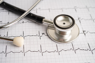 Stethoscope on electrocardiogram ECG, heart wave, heart attack, cardiogram report.