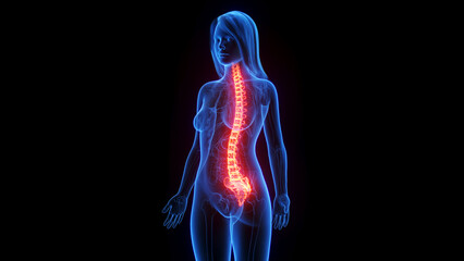 3d rendered medical illustration of a woman's spine