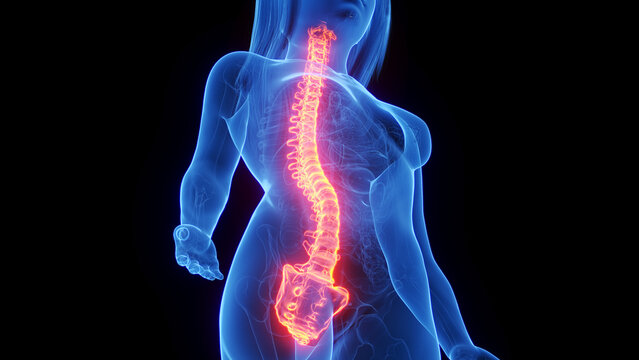 3d rendered medical illustration of a woman's spine