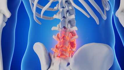 3d rendered medical illustration of a man's lumbar spine
