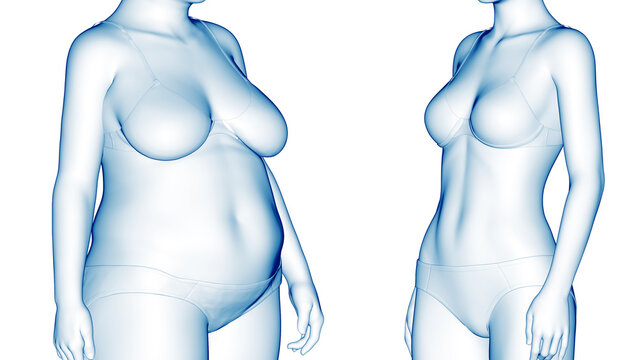 3d rendered medical illustration of an overweight woman's weight loss