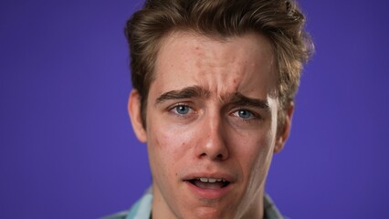 Closeup of sad tired fatigued headache exhausted young man 20s posing isolated on purple background studio. People lifestyle concept. Put hands on head