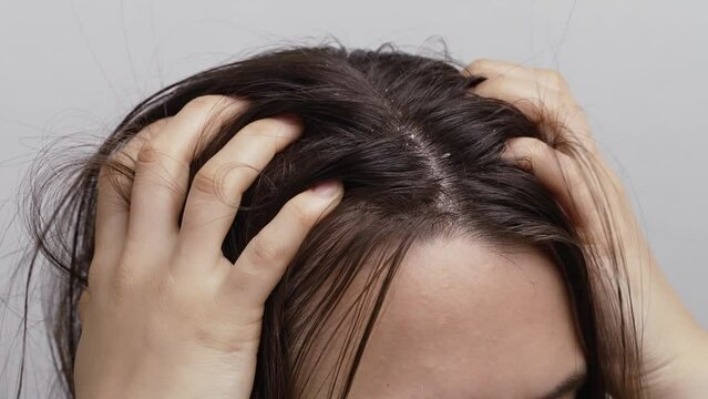 Woman scratching her head with dandruff