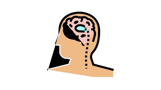 shunt insertion or revision color icon animation