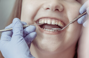 Close-up woman smiling on checkup at dentist in dental clinic