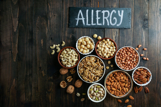 Allergy concept - Nuts variety in the bowls - cashew, hazelnut, macadamia, pistachio, almond, walnut, peanut, pecan