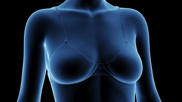 3d rendered medical animation of a woman after breast enhancement