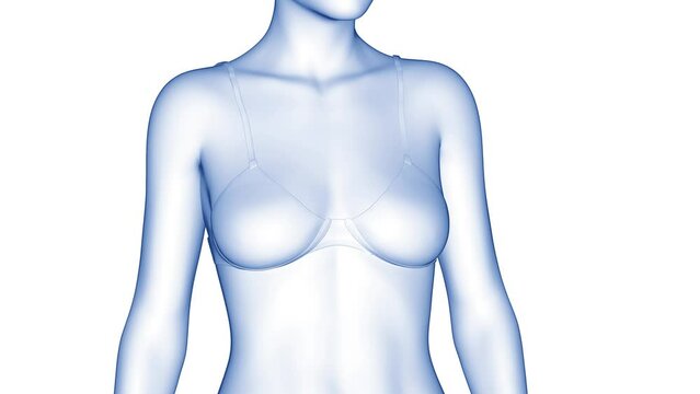 3d rendered medical animation of a woman's transformation after breast surgery