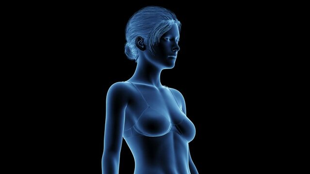 3d rendered medical animation of a woman after breast enhancement