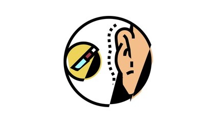 otoplasty surgery color icon animation