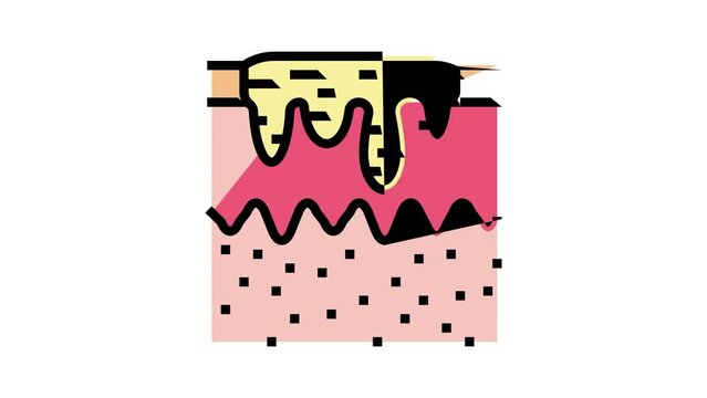 hyperpigmentation acne scar color icon animation
