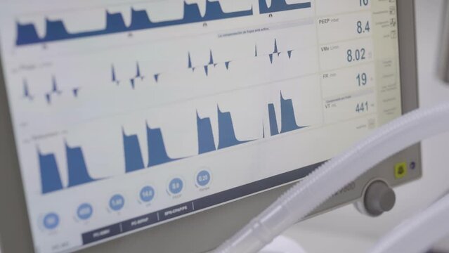 Monitoring vital parameters with a modern laptop connected to the patient in a hospital private clinic for health and care 