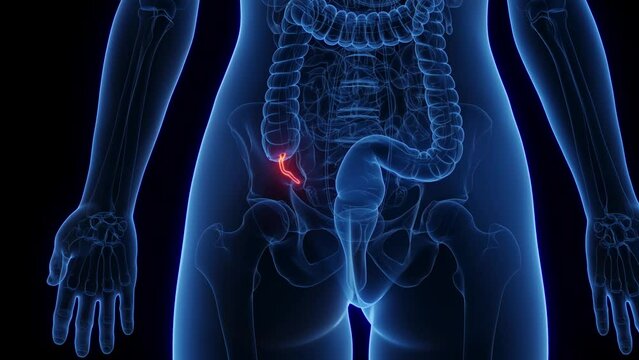 3d rendered medical animation of the appendix of a woman