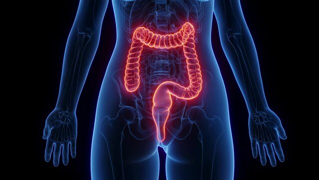 3d rendered medical animation of a woman's colon and rectum