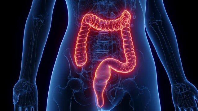 3d rendered medical animation of a woman's colon and rectum