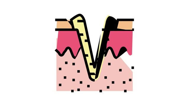 ice pick acne scar color icon animation