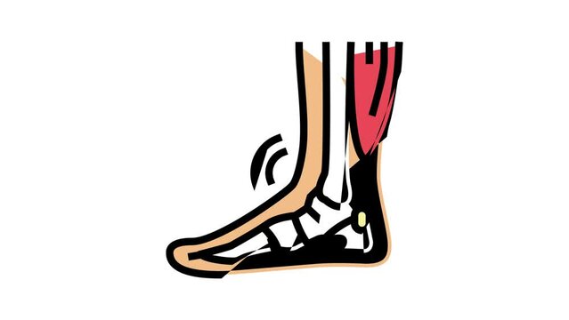 tendonitis problem color icon animation