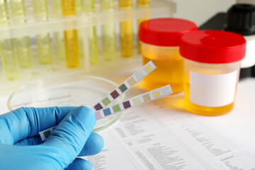 Nurse holding test strips at table, closeup. Urine analysis
