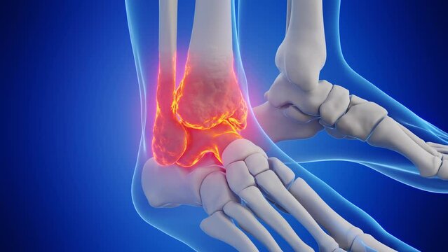3d rendered medical animation of a man's right ankle
