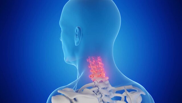 3d rendered medical animation of a man's neck
