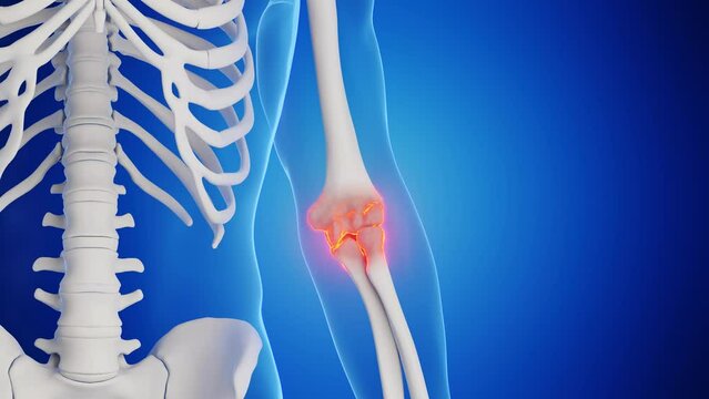 3d rendered medical animation of a man's left elbow