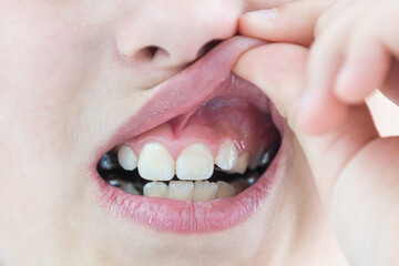 Portrait of little cute girl shows her orthodontic appliance on a white background