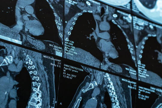 Close up of a body CT scan background