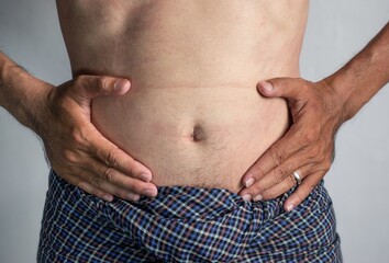 Naklejka premium Abdomen of Asian man. Concept of central obesity, belly fat, abdominal bloating or fullness.
