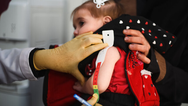 Doctor examines child malnutrition. Measuring malnutrition using strap MUAC mid-upper-arm-circumference.	

