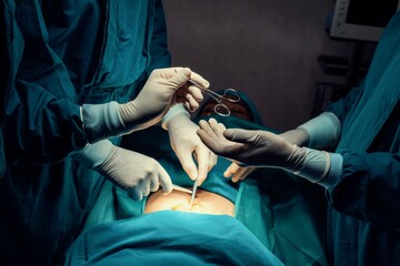 Image of surgical team perform surgery operation, nurse hand out sterile scissors to surgeon as...