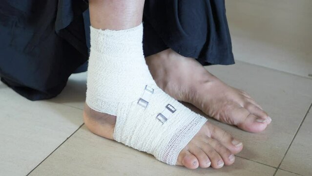 Woman with bandaged foot close up 