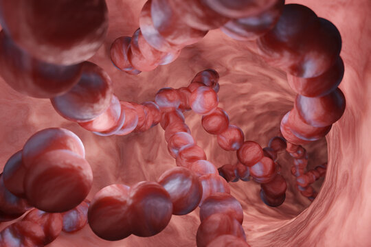 Strep A bacterial structure in a throat. Illustration of the infection of invasive group A streptococcal (iGAS) disease