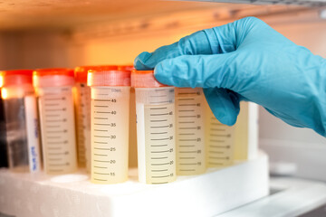 Closeup shot, a hand of scientist checking stock solution of the sample in the refrigerator for bioassay in vitro cells. Medicinal, Medicine, and Biochemistry research.