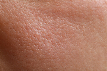 Closeup view of human oily skin as background