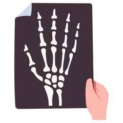 Hand bone x-ray