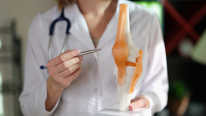 Female physiotherapist holds anatomical model of human knee joint and pen in her hands.