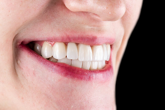 dental photography picture of dental treatment case