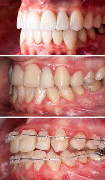 dental photography picture of dental treatment case