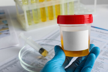 Nurse holding container with urine sample at table, closeup and space for text. Specimen collection