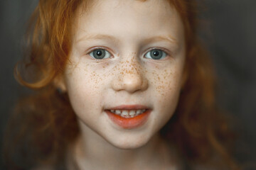 Smiling cute girl with freckles on face