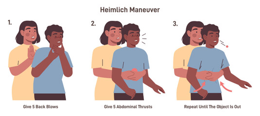 Choking first aid for adult. Heimlich maneuver procedure to remove