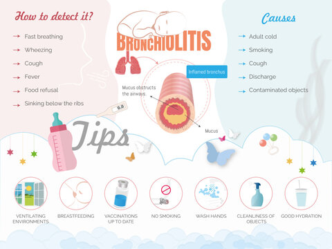 Infographic of bronchiolitis, how to detect it, symptoms and tips with icons of ventilation, breastfeeding, not smoking, hand washing, cleaning and hydration.