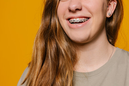 Smiling girl with brackets with long hair in studio