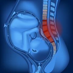Pain in the spine and back during pregnancy. baby in the uterus. Neon rendering of female anatomy. Blue background for advertising. Vector illustration