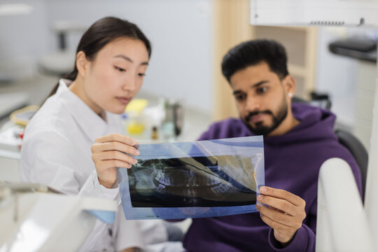 Focus on x ray picture, attractive young bearded man, sitting on dentist chair and looking at x-ray scan image of teeth together with his cheerful female asian dentist at clinic.